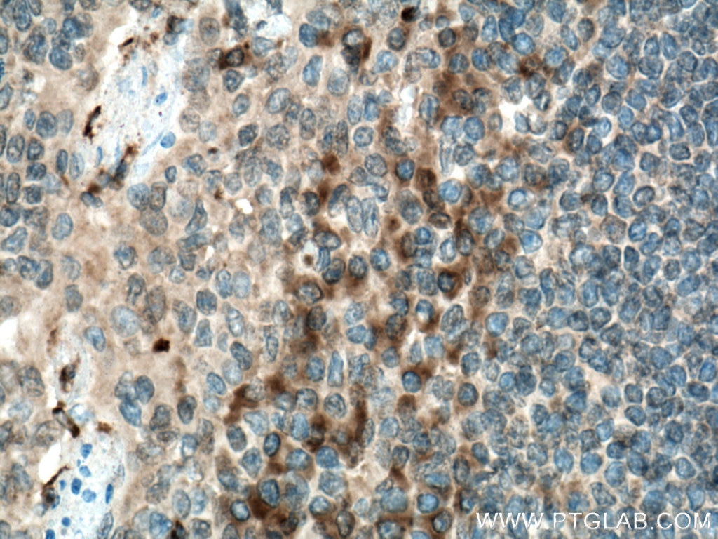 IHC staining of human tonsillitis using Biotin-66502