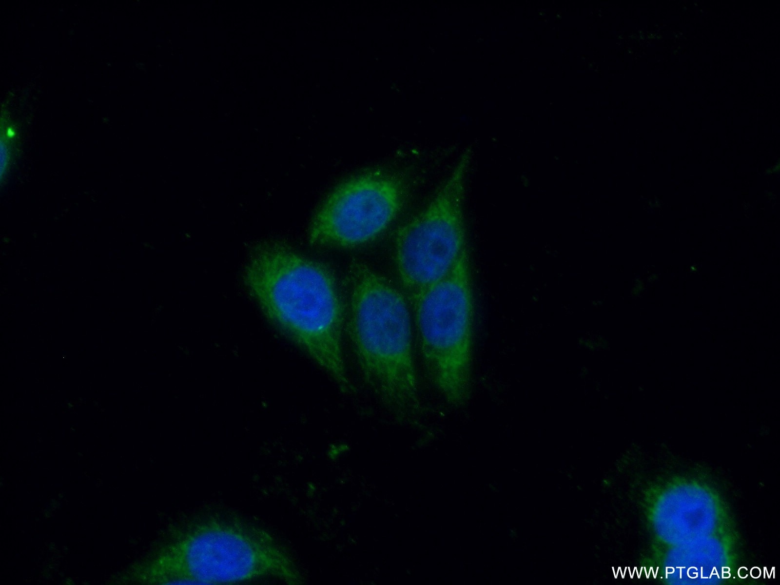 Immunofluorescence (IF) / fluorescent staining of HeLa cells using CD40L/CD154 Polyclonal antibody (16668-1-AP)