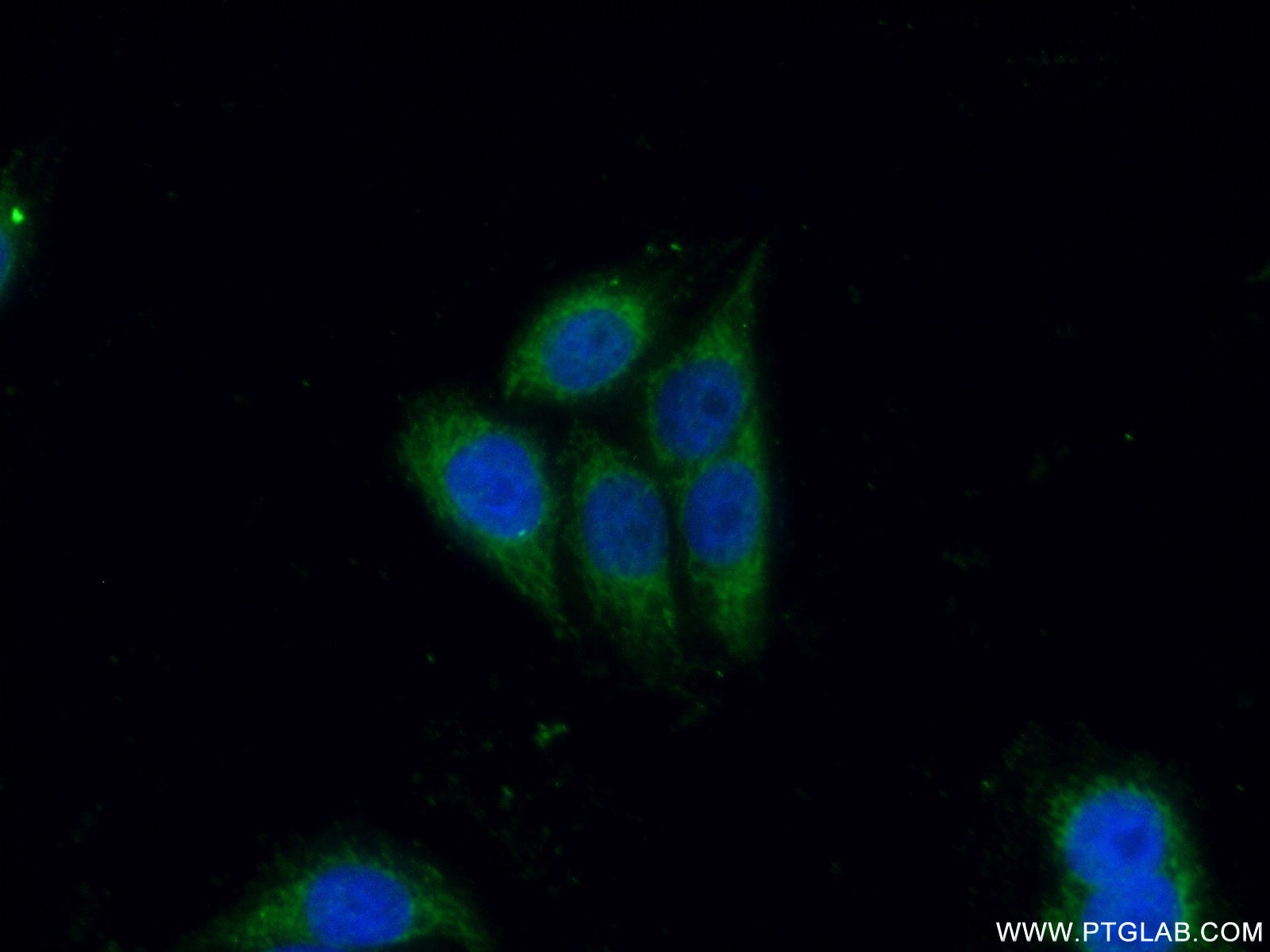 CD40L/CD154