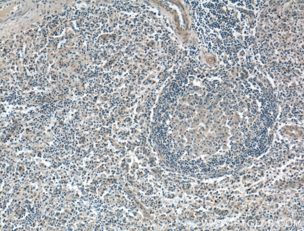 Immunohistochemistry (IHC) staining of human spleen tissue using CD40L/CD154 Polyclonal antibody (16668-1-AP)