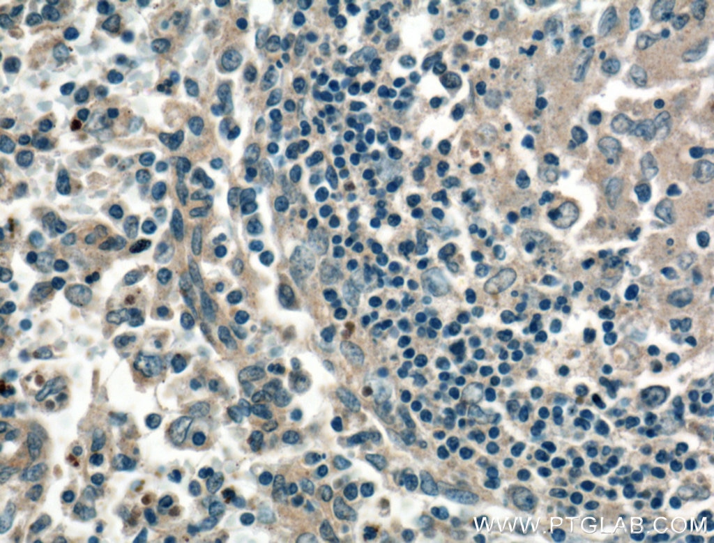 IHC staining of human spleen using 16668-1-AP