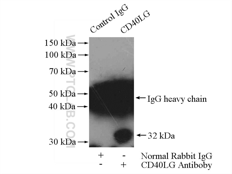 Immunoprecipitation (IP) experiment of Jurkat cells using CD40L/CD154 Polyclonal antibody (16668-1-AP)