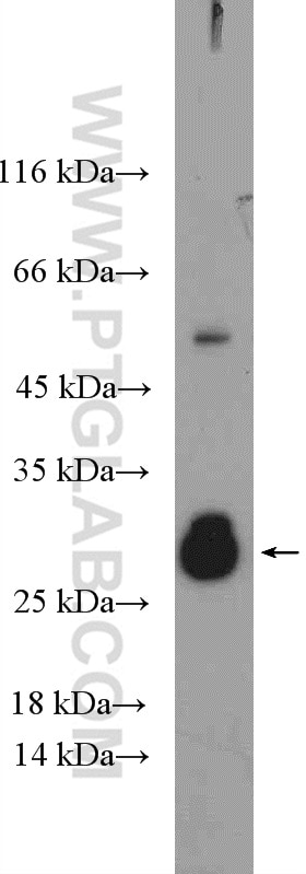 Western Blot (WB) analysis of HeLa cells using CD40L/CD154 Polyclonal antibody (16668-1-AP)