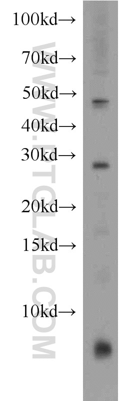 Western Blot (WB) analysis of Jurkat cells using CD40L/CD154 Polyclonal antibody (16668-1-AP)