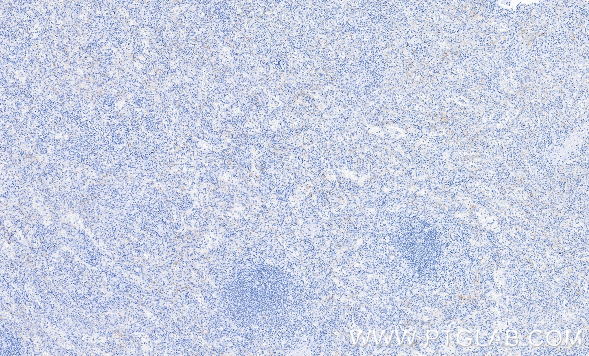IHC staining of human spleen using 87447-4-RR Immunohistochemistry (IHC) staining of human spleen tissue using CD41 Recombinant monoclonal antibody (87447-4-RR)