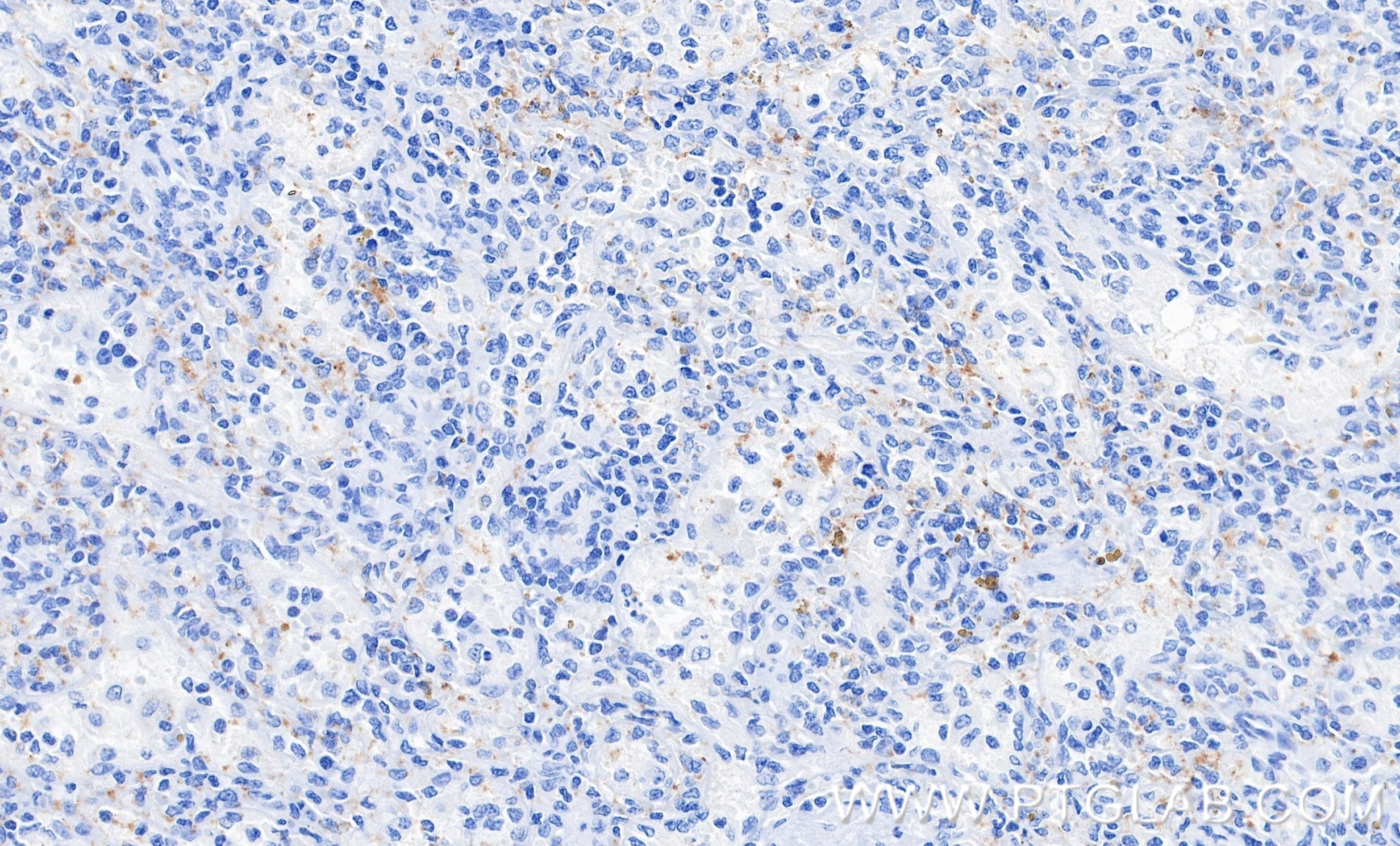 IHC staining of human spleen using 87447-4-RR Immunohistochemistry (IHC) staining of human spleen tissue using CD41 Recombinant monoclonal antibody (87447-4-RR)