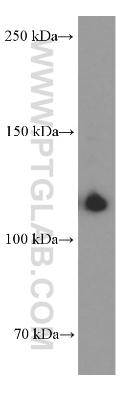 Western Blot (WB) analysis of human spleen tissue using CD41/Integrin Alpha 2B Monoclonal antibody (60350-1-Ig)