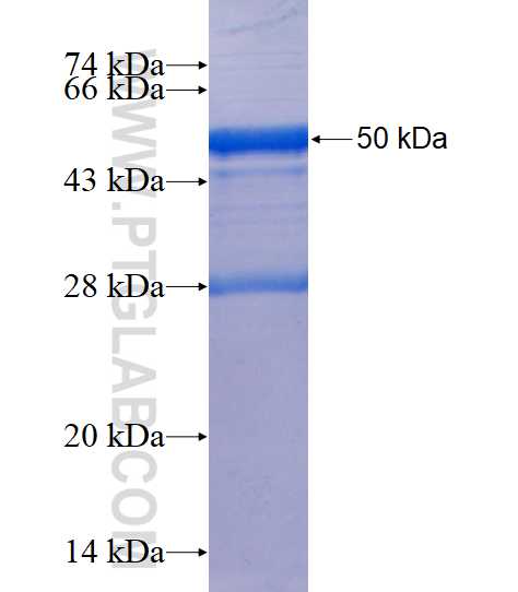 CD41/Integrin alpha 2b fusion protein Ag19459 SDS-PAGE
