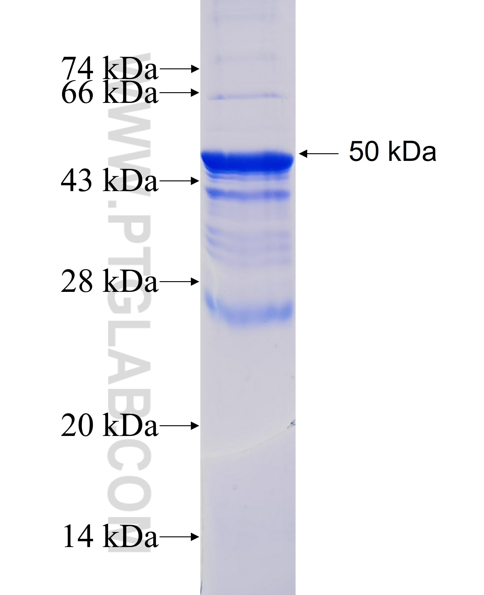 CD41/Integrin alpha 2b fusion protein Ag19459 SDS-PAGE