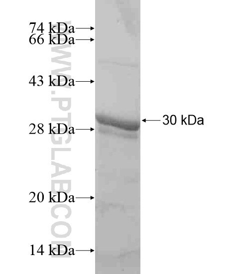CD41/Integrin alpha 2b fusion protein Ag19469 SDS-PAGE