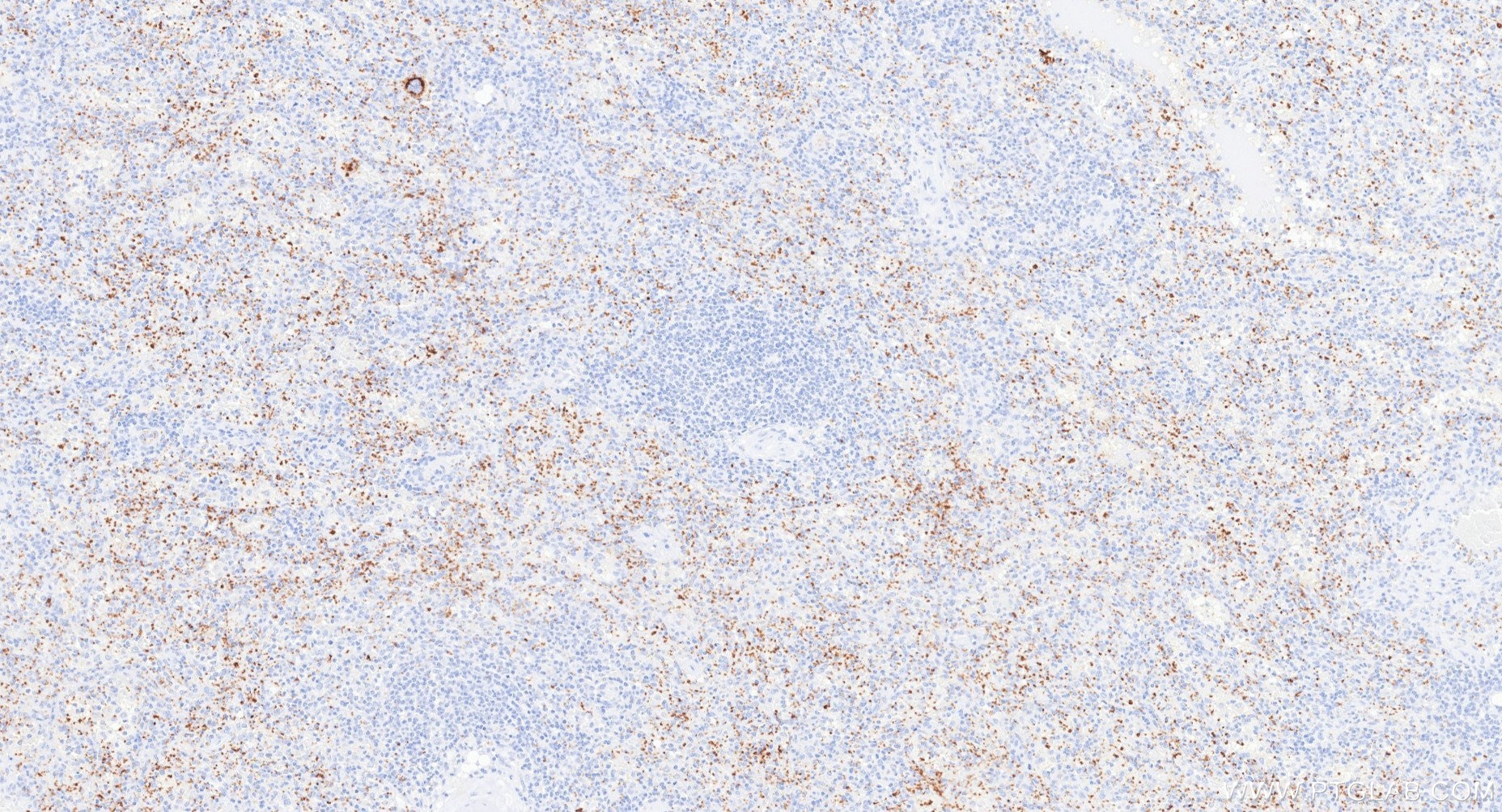 Immunohistochemistry (IHC) staining of human spleen tissue using CD42b Recombinant monoclonal antibody (87285-3-RR)