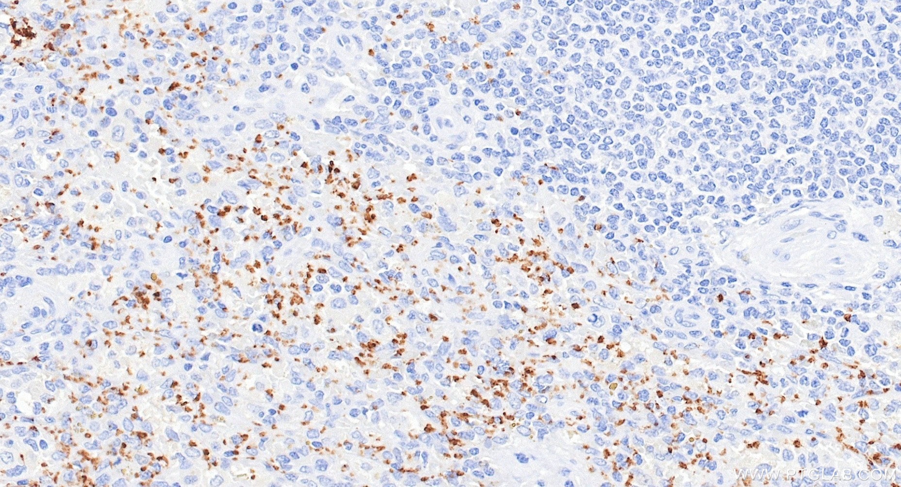 Immunohistochemistry (IHC) staining of human spleen tissue using CD42b Recombinant monoclonal antibody (87285-3-RR)