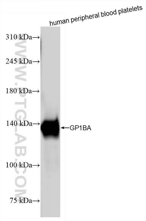Human peripheral blood platelets were subjected to SDS PAGE followed by western blot with 87285-3-RR (CD42b antibody) at dilution of 1:10000 incubated at room temperature for 1.5 hours. Western Blot (WB) analysis of human peripheral blood platelets using CD42b Recombinant monoclonal antibody (87285-3-RR)
