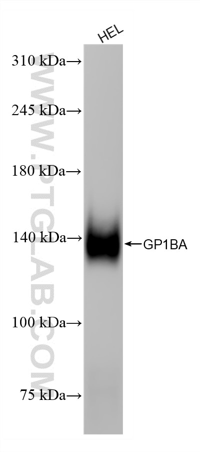 HEL cells were subjected to SDS PAGE followed by western blot with 87285-3-RR (CD42b antibody) at dilution of 1:10000 incubated at room temperature for 1.5 hours. Western Blot (WB) analysis of HEL cells using CD42b Recombinant monoclonal antibody (87285-3-RR)