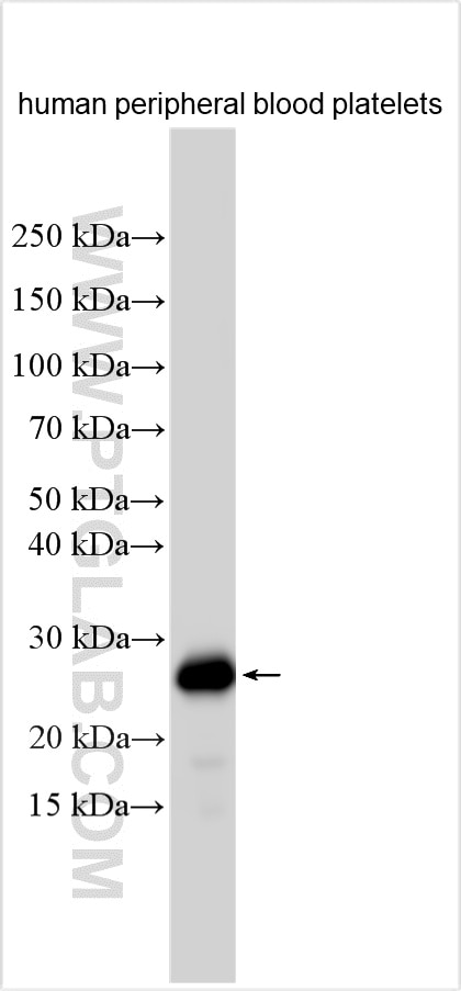 Western Blot (WB) analysis of various lysates using CD42c Polyclonal antibody (32462-1-AP)