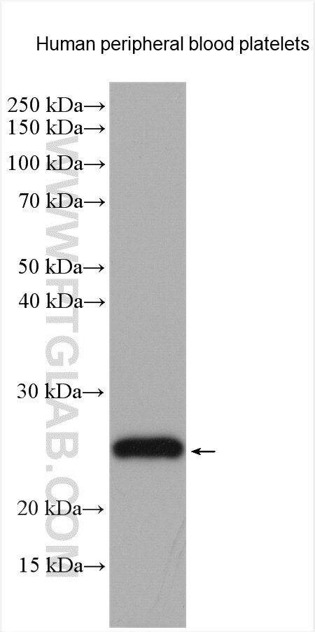 Western Blot (WB) analysis of various lysates using CD42c Polyclonal antibody (55161-1-AP)