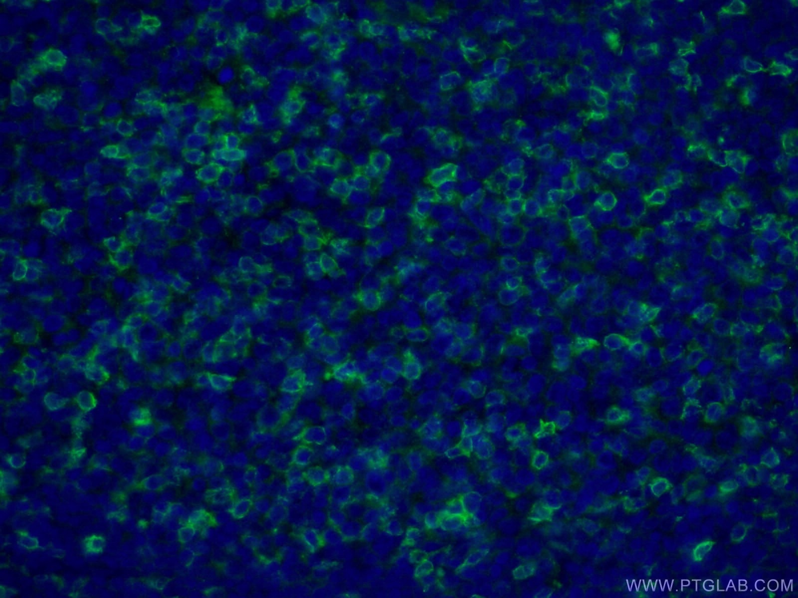 Immunofluorescence (IF) / fluorescent staining of human tonsillitis tissue using CD43 Monoclonal antibody (66224-1-Ig)