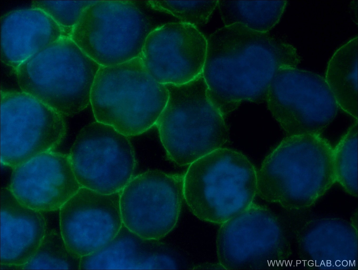 Immunofluorescence (IF) / fluorescent staining of Jurkat cells using CD43 Monoclonal antibody (66224-1-Ig)