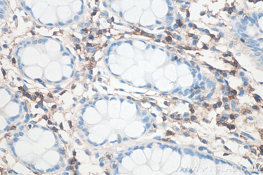 Immunohistochemistry (IHC) staining of human colon tissue using CD43 Monoclonal antibody (66224-1-Ig)