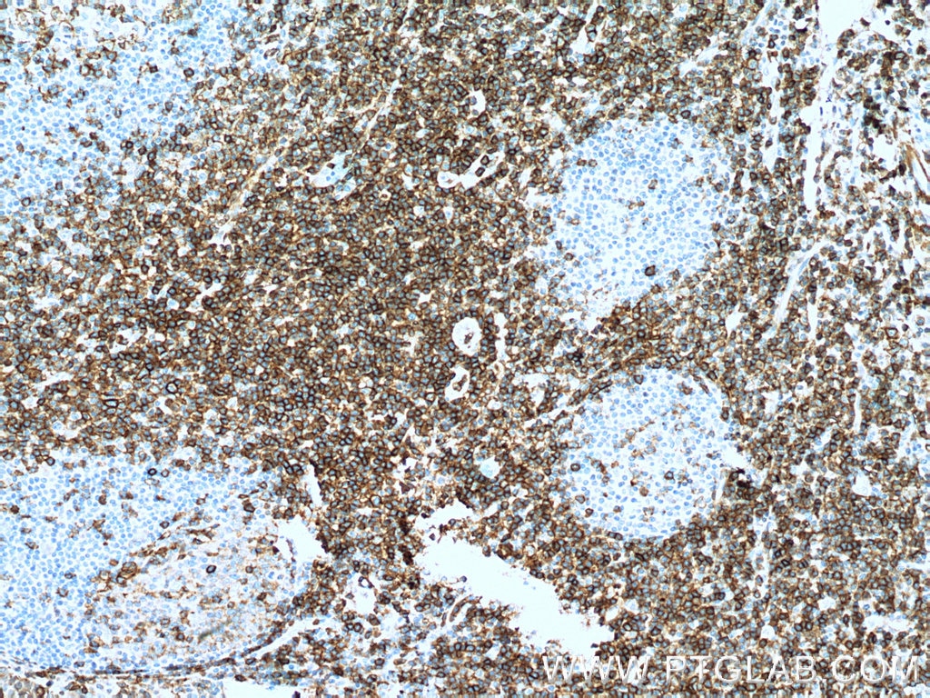CD43 Monoclonal antibody
