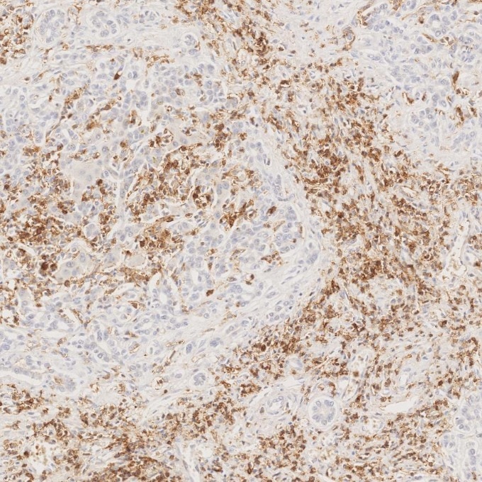 Immunohistochemistry (IHC) staining of human liver tissue using CD43 Monoclonal antibody (66224-1-Ig)