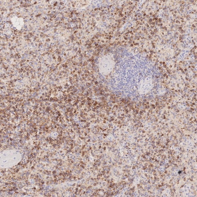 Immunohistochemistry (IHC) staining of human spleen tissue using CD43 Monoclonal antibody (66224-1-Ig)