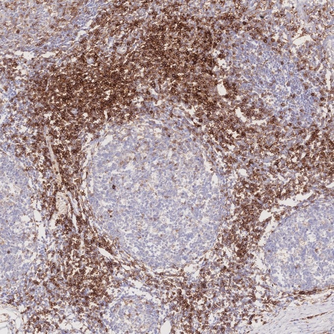 Immunohistochemistry (IHC) staining of human tonsillitis tissue using CD43 Monoclonal antibody (66224-1-Ig)
