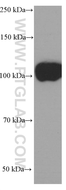 Western Blot (WB) analysis of Jurkat cells using CD43 Monoclonal antibody (66224-1-Ig)