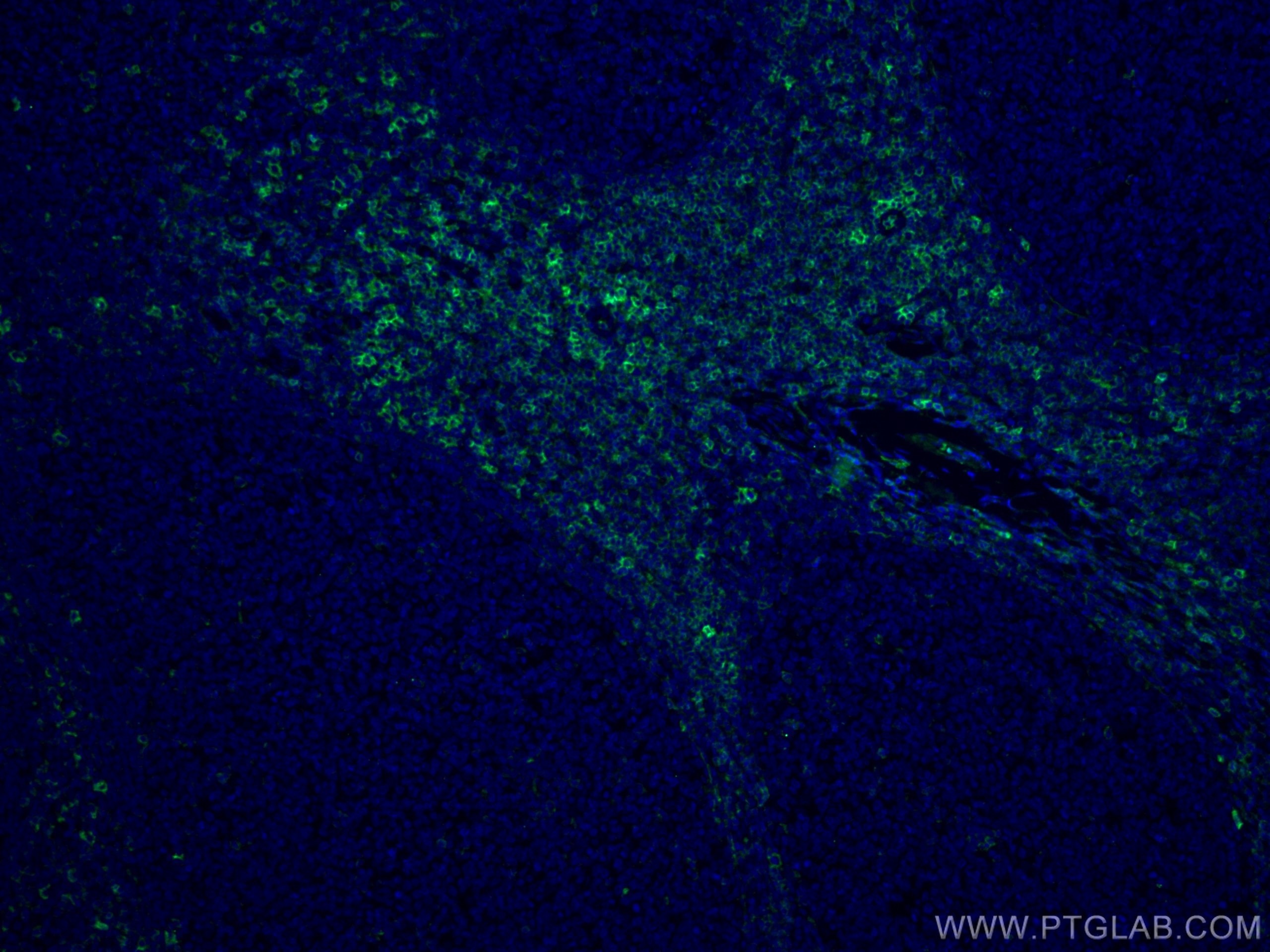 Immunofluorescence (IF) / fluorescent staining of human tonsillitis tissue using CoraLite® Plus 488-conjugated CD43 Monoclonal anti (CL488-66224)