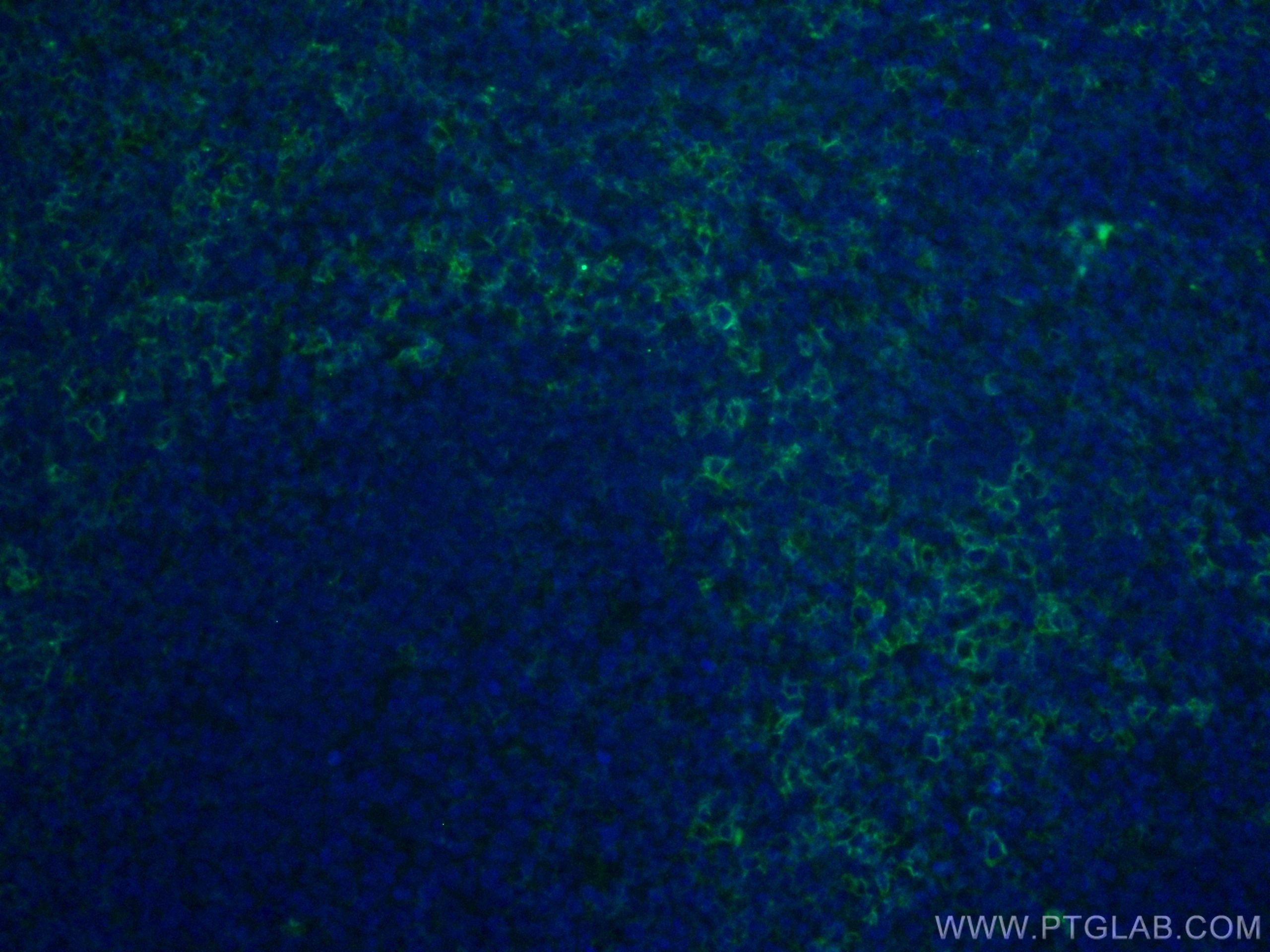 Immunofluorescence (IF) / fluorescent staining of human tonsillitis tissue using CoraLite® Plus 488-conjugated CD43 Monoclonal anti (CL488-66224)