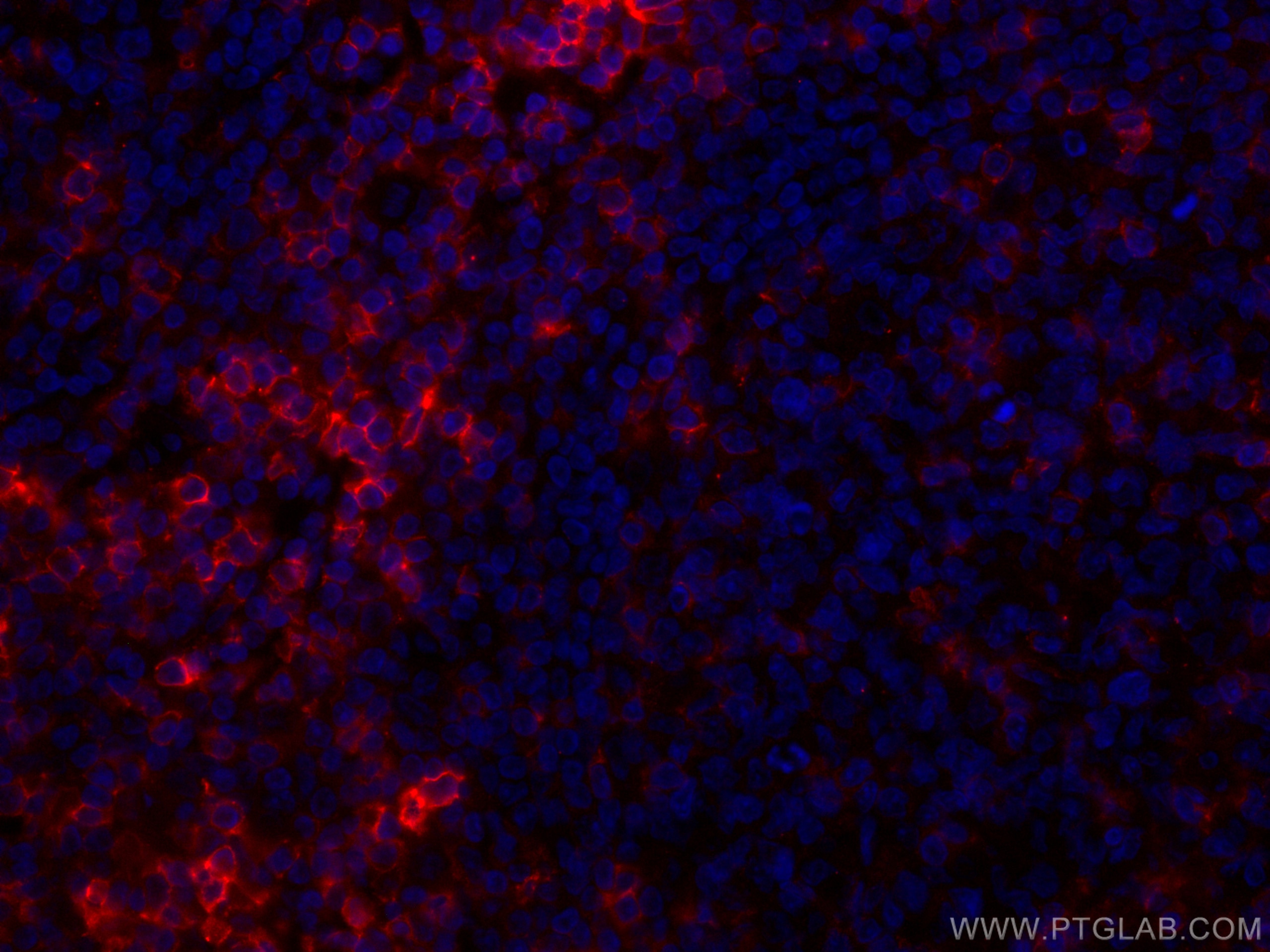 Immunofluorescence (IF) / fluorescent staining of human tonsillitis tissue using CoraLite®594-conjugated CD43 Monoclonal antibody (CL594-66224)