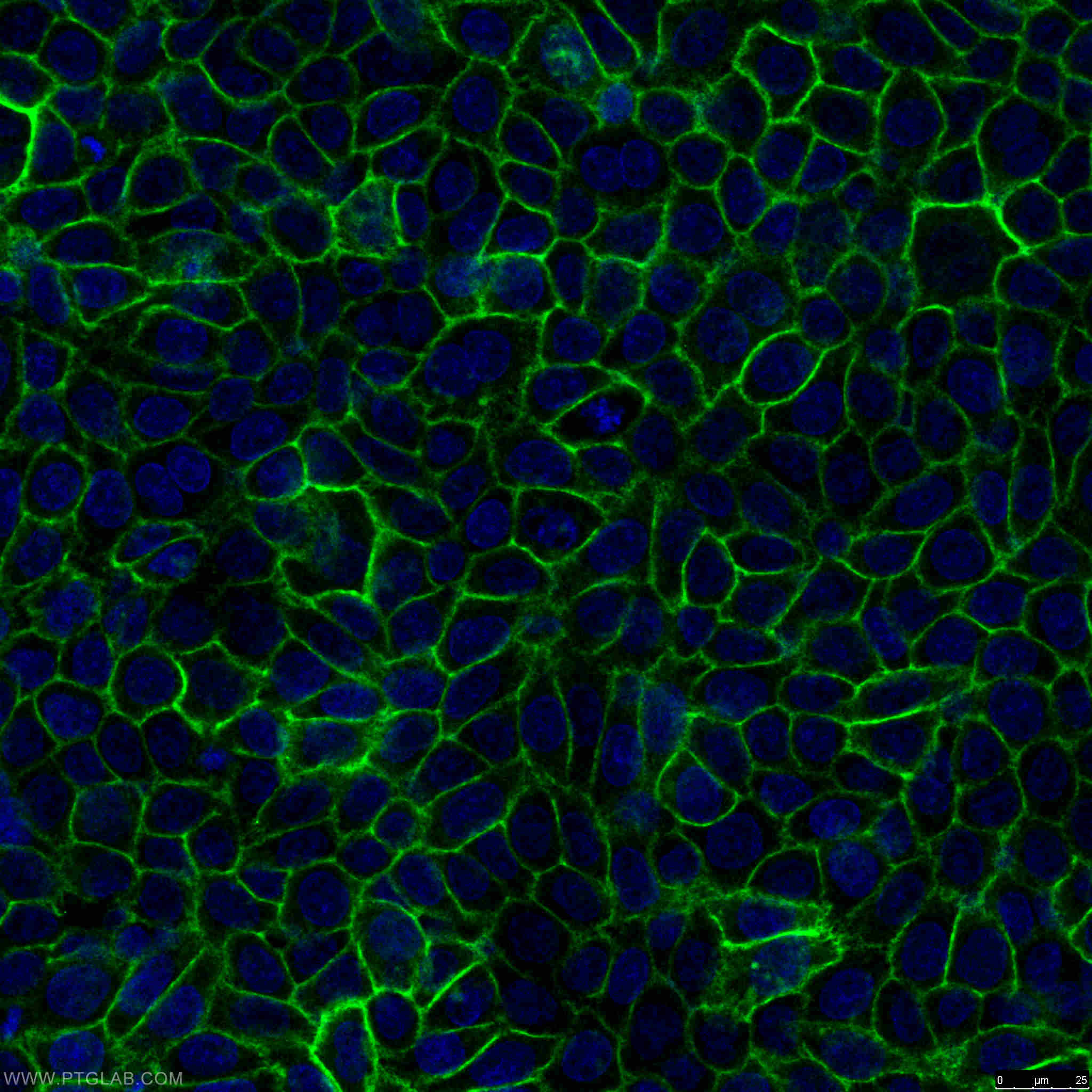 IF Staining of HeLa using 15675-1-AP