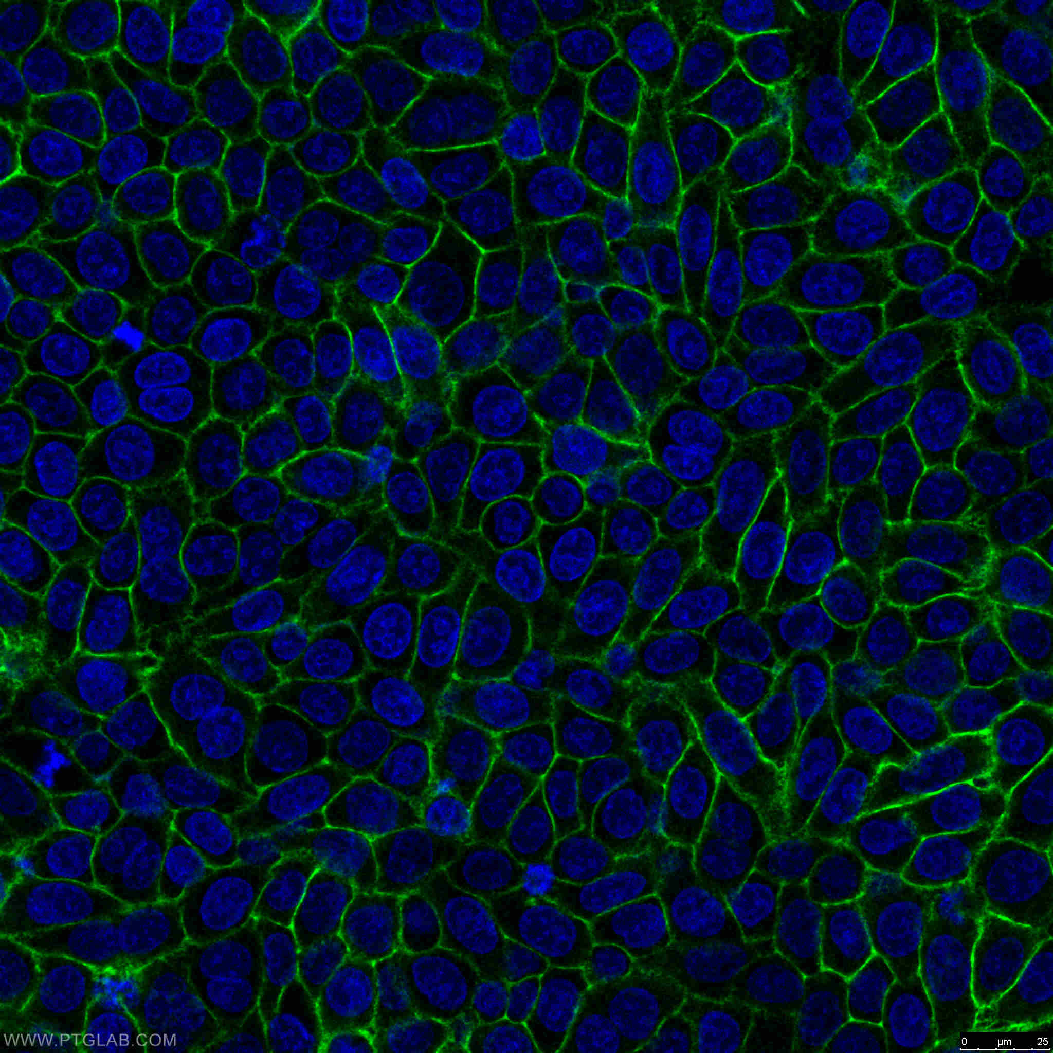 IF Staining of HeLa using 15675-1-AP