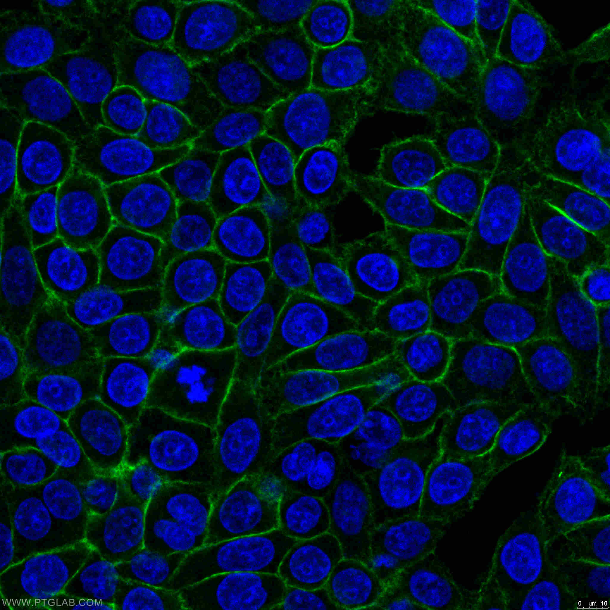 Immunofluorescence (IF) / fluorescent staining of HeLa cells using CD44 Polyclonal antibody (15675-1-AP)