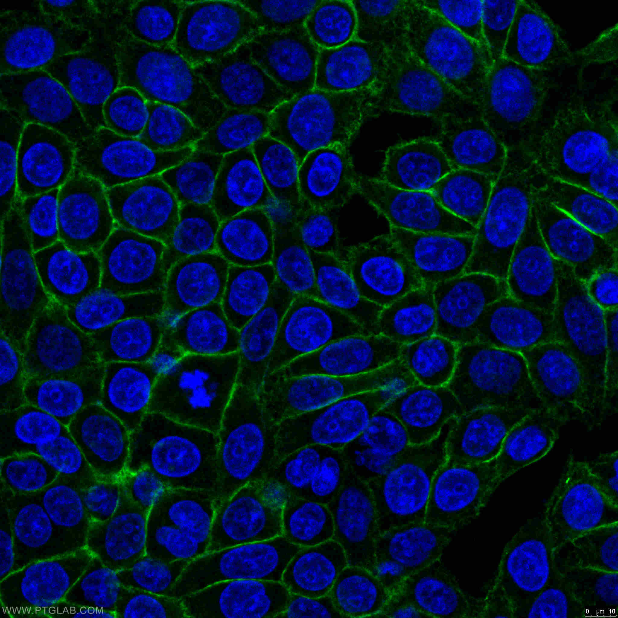 IF Staining of HeLa using 15675-1-AP