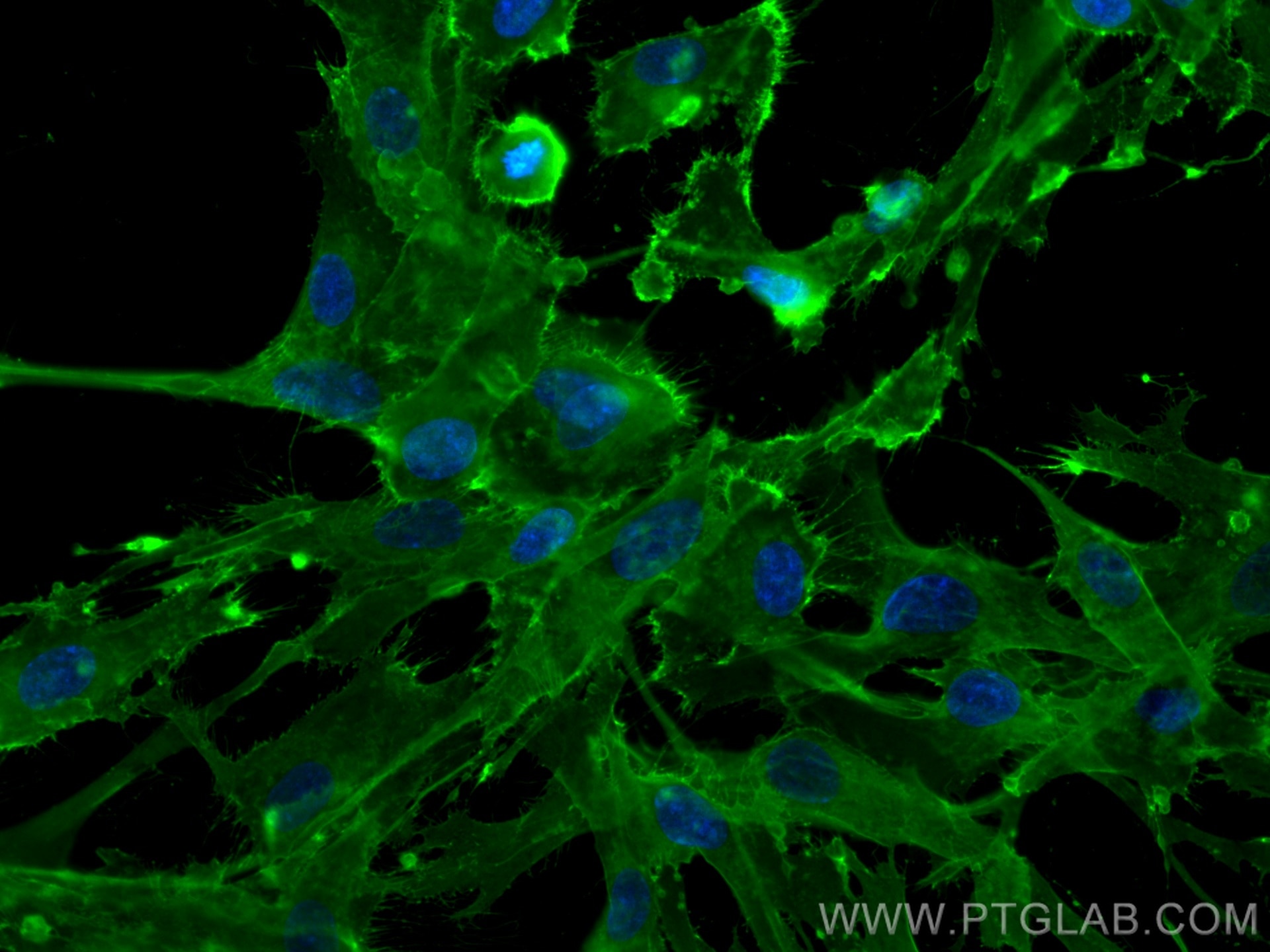 Immunofluorescence (IF) / fluorescent staining of UCMSCs cells using CD44 Polyclonal antibody (15675-1-AP)