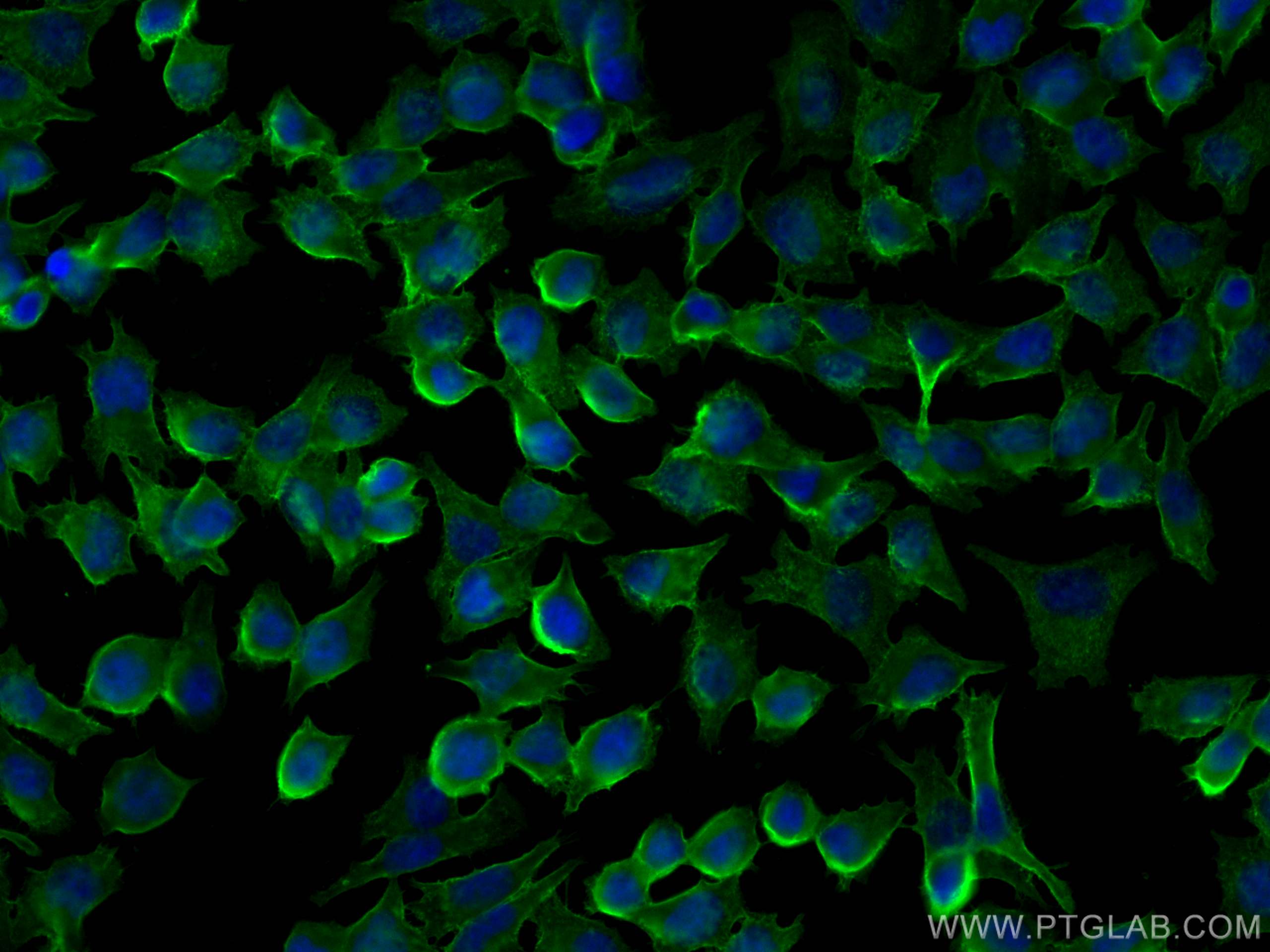Immunofluorescence (IF) / fluorescent staining of A375 cells using CD44 Polyclonal antibody (15675-1-AP)