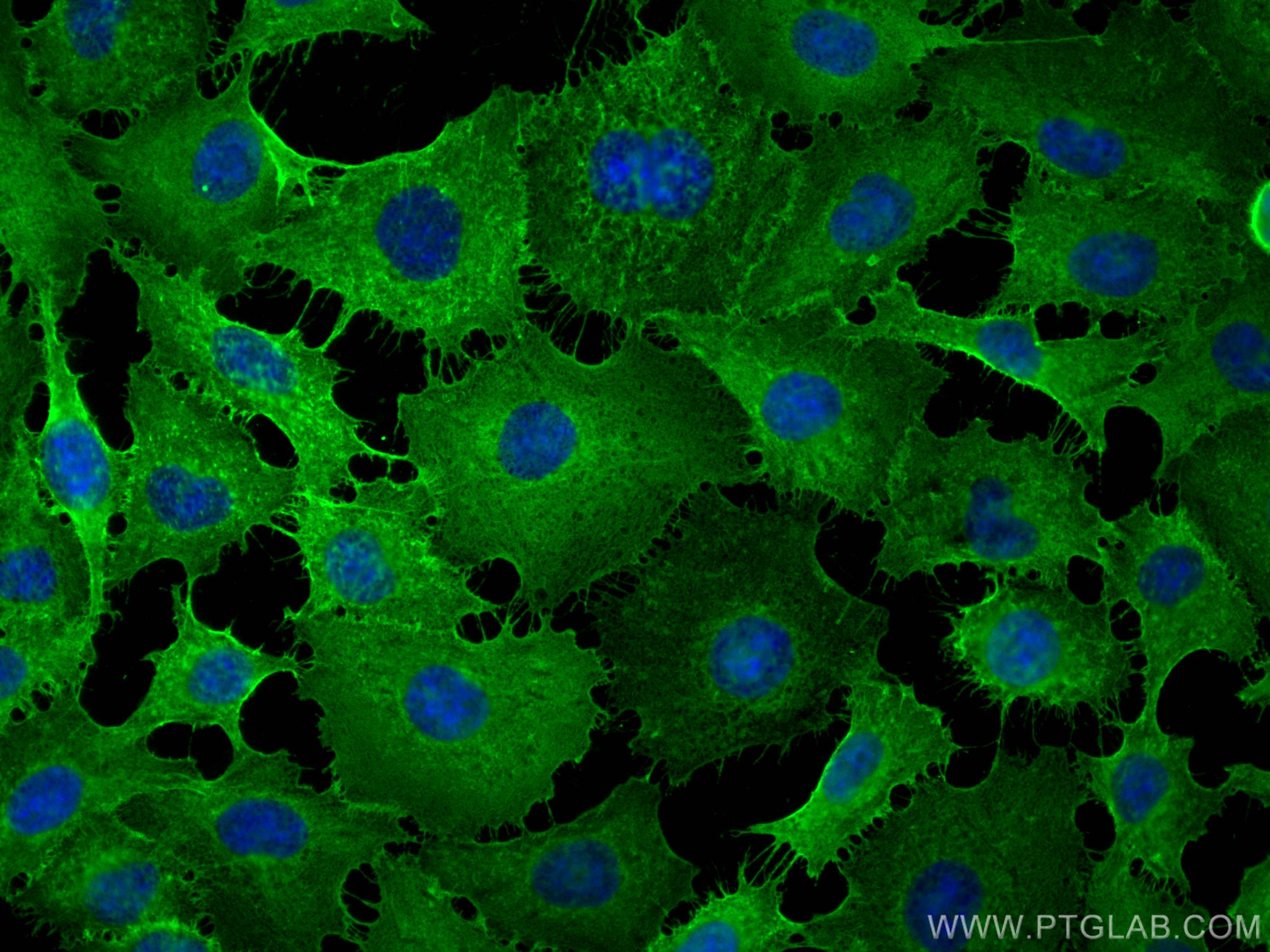 Immunofluorescence (IF) / fluorescent staining of HUVEC cells using CD44 Polyclonal antibody (15675-1-AP)