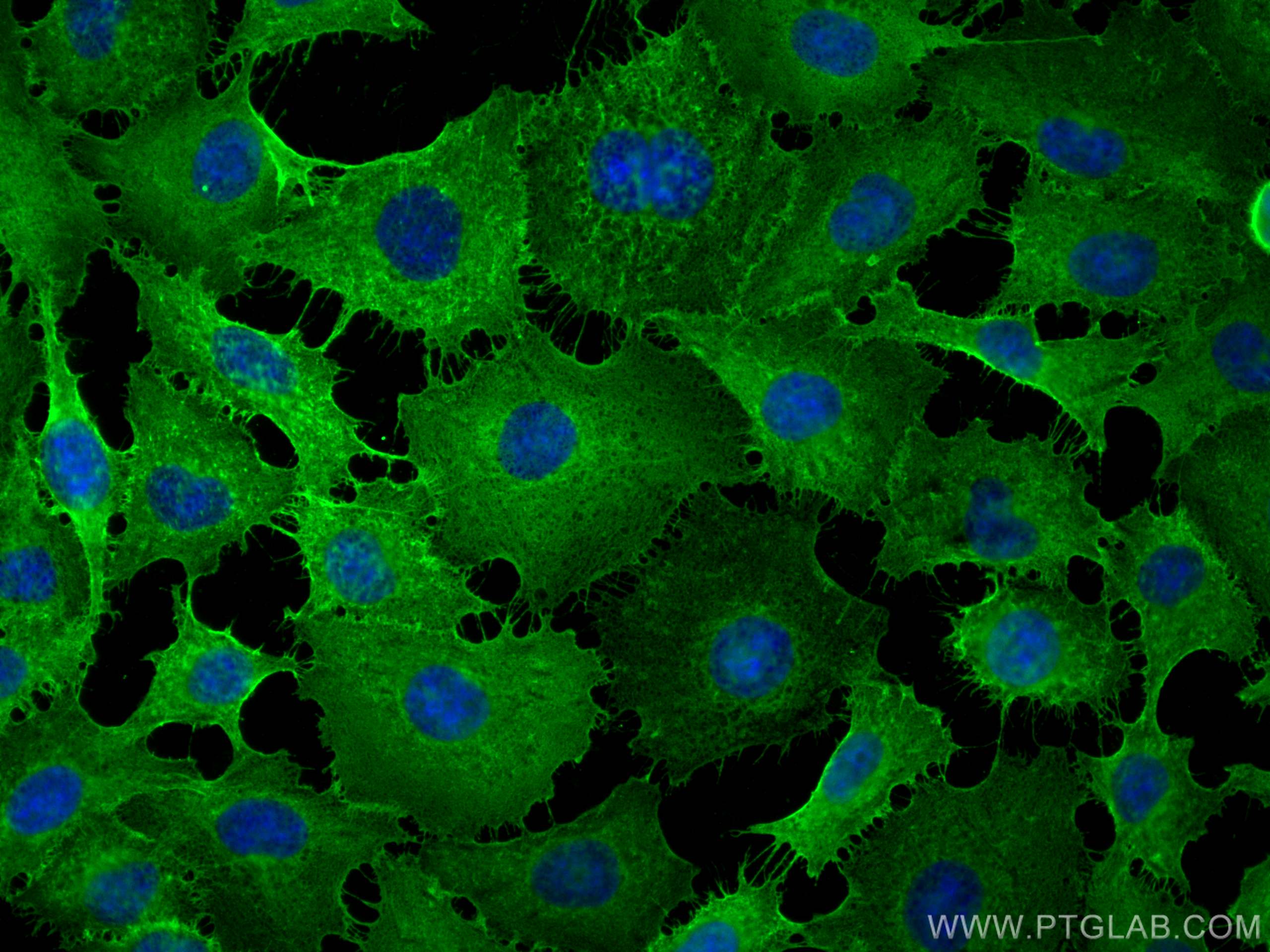 IF Staining of HUVEC using 15675-1-AP