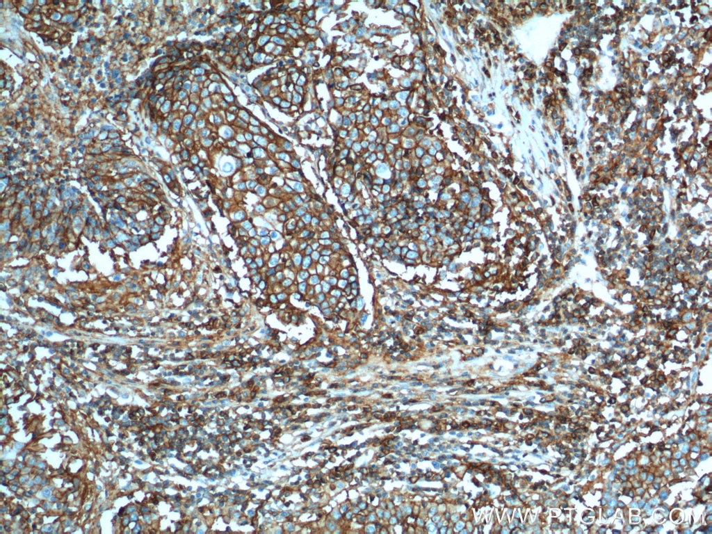 CD44 Polyclonal antibody