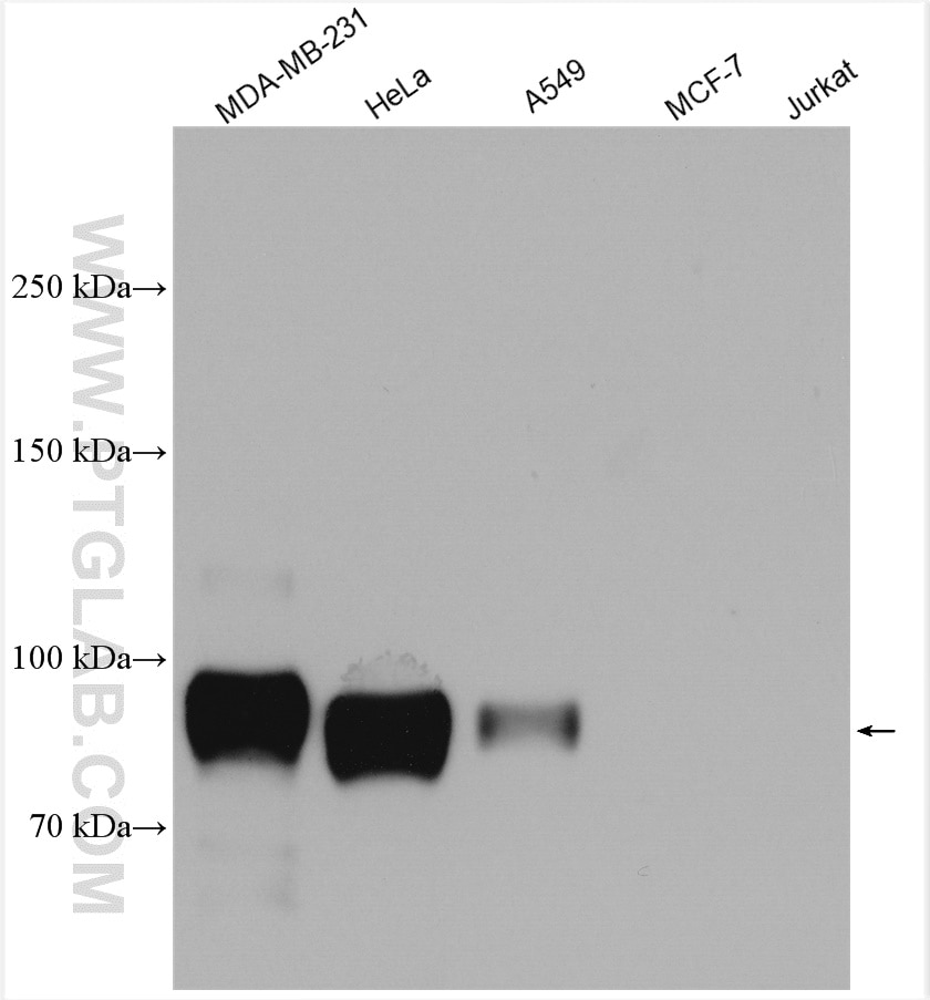 Western Blot (WB) analysis of various lysates using CD44 Polyclonal antibody (15675-1-AP)