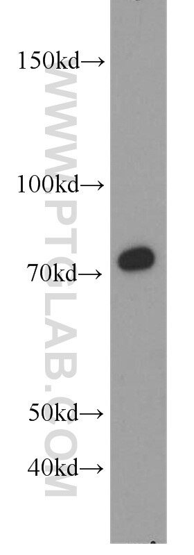 Western Blot (WB) analysis of mouse thymus tissue using CD44 Polyclonal antibody (15675-1-AP)