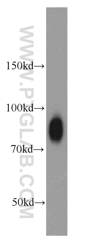 Western Blot (WB) analysis of HeLa cells using CD44 Polyclonal antibody (15675-1-AP)