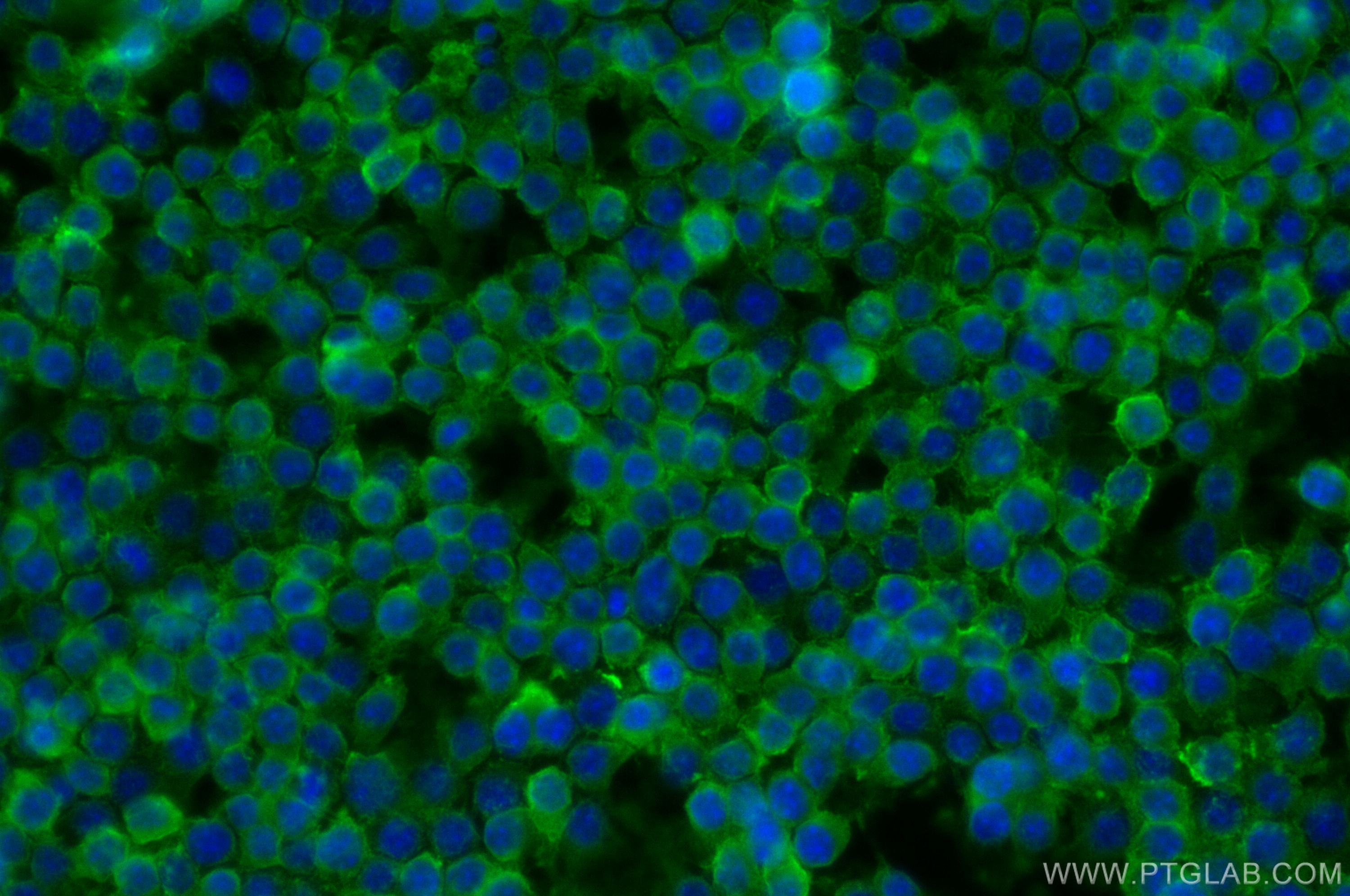 Immunofluorescence (IF) / fluorescent staining of RAW 264.7 cells using CD44 Polyclonal antibody (30854-1-AP)