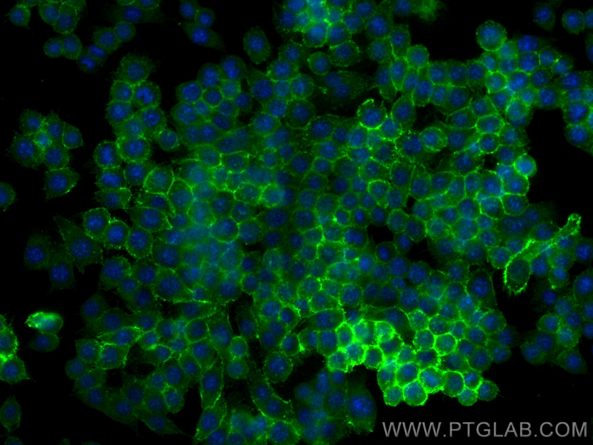 Immunofluorescence (IF) / fluorescent staining of RAW 264.7 cells using CD44 Polyclonal antibody (30854-1-AP)