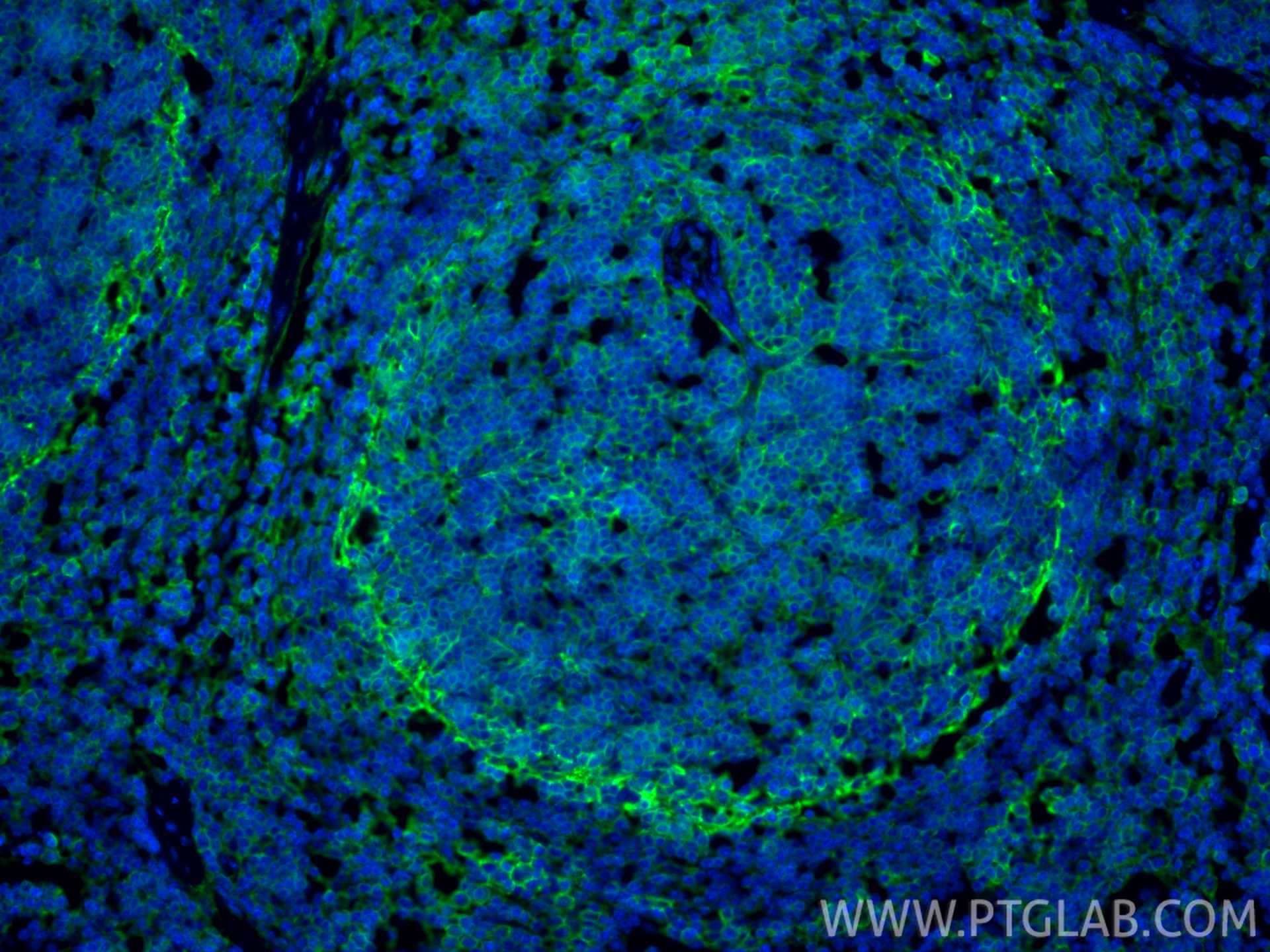 Immunofluorescence (IF) / fluorescent staining of mouse spleen tissue using CD44 Polyclonal antibody (30854-1-AP)