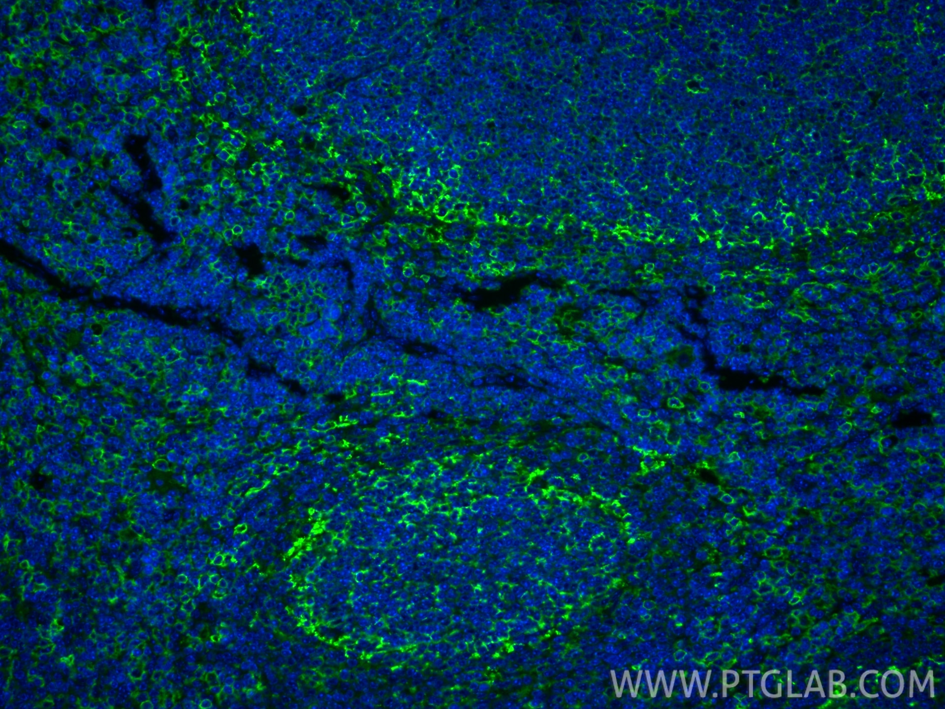 Immunofluorescence (IF) / fluorescent staining of mouse spleen tissue using CD44 Polyclonal antibody (30854-1-AP)