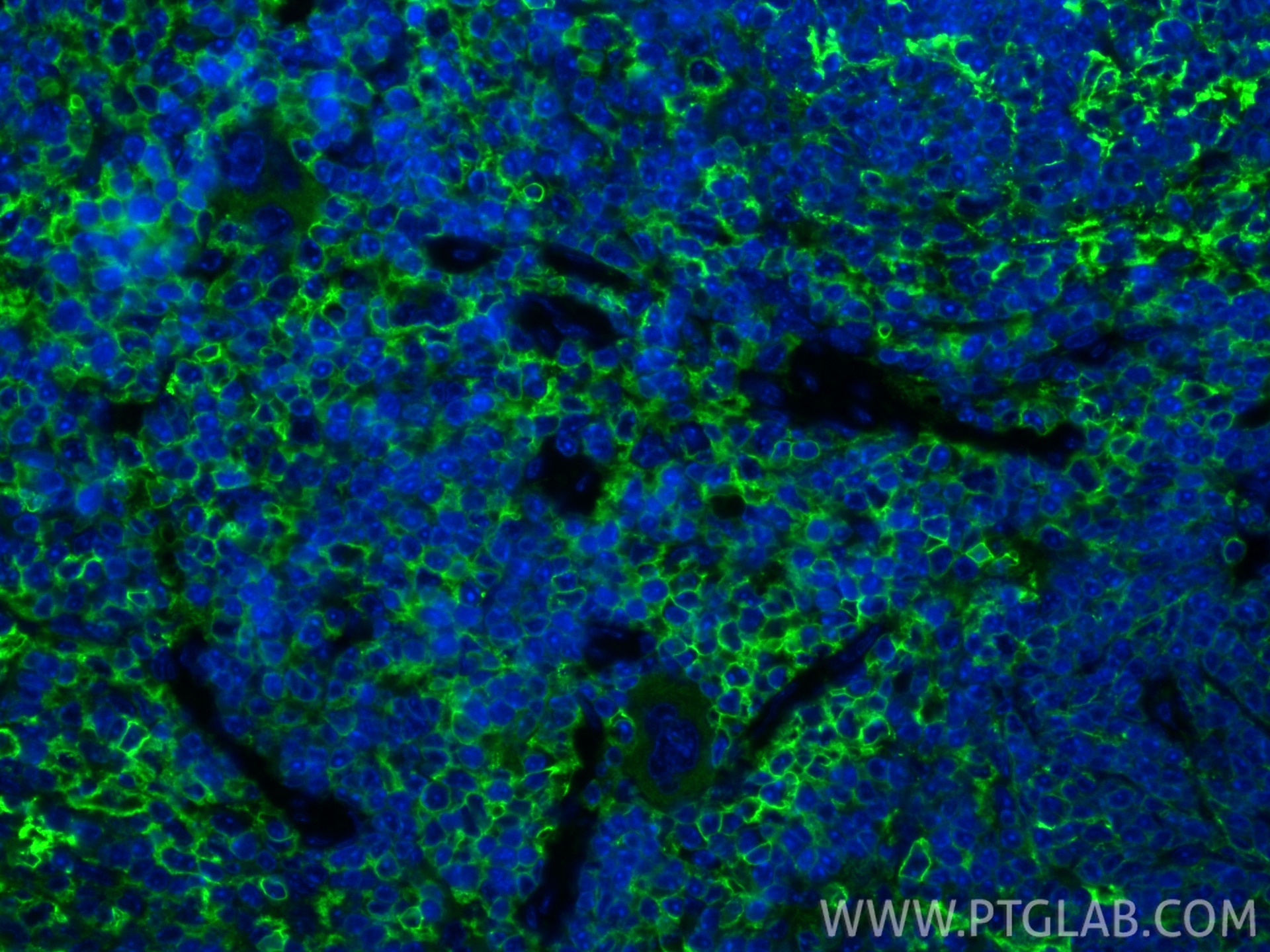 Immunofluorescence (IF) / fluorescent staining of mouse spleen tissue using CD44 Polyclonal antibody (30854-1-AP)