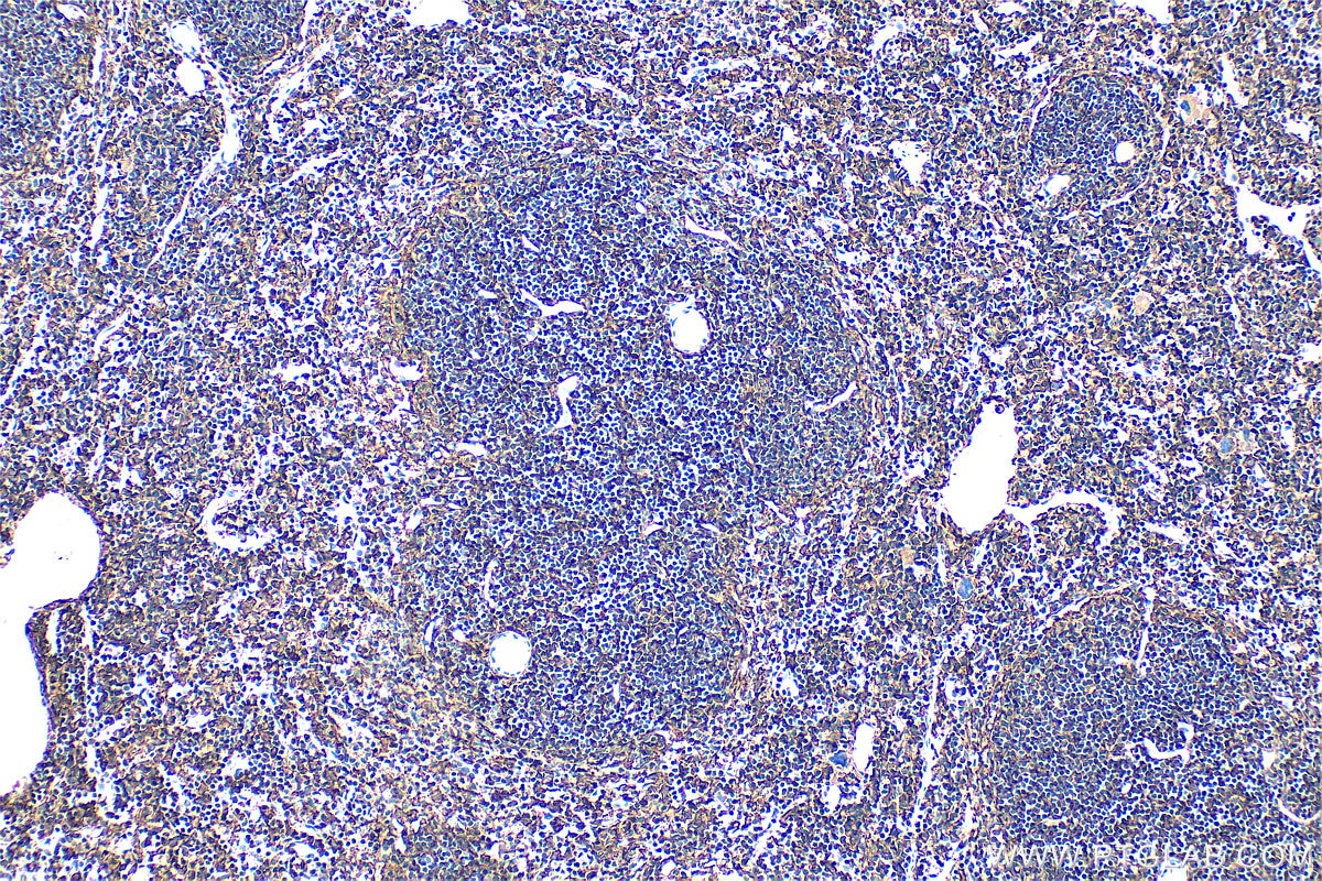 Immunohistochemistry (IHC) staining of mouse spleen tissue using CD44 Polyclonal antibody (30854-1-AP)