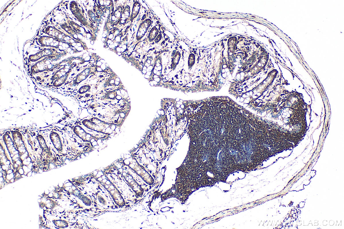 Immunohistochemistry (IHC) staining of mouse colon tissue using CD44 Polyclonal antibody (30854-1-AP)